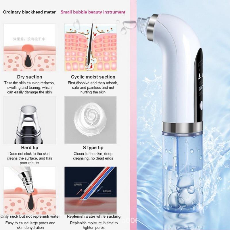 Electric Bubble Vacuum Suction Blackhead Remover - Relax with Beauty